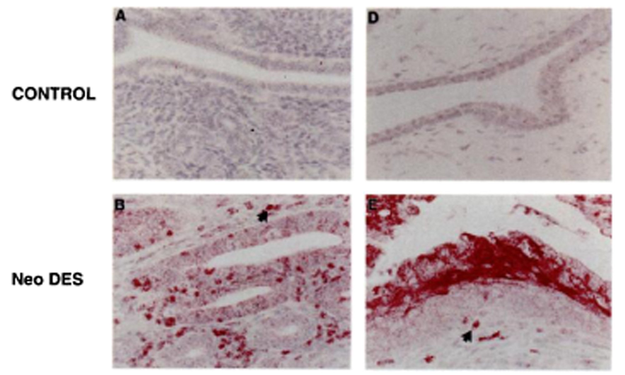 image of estrogen-regulated genes