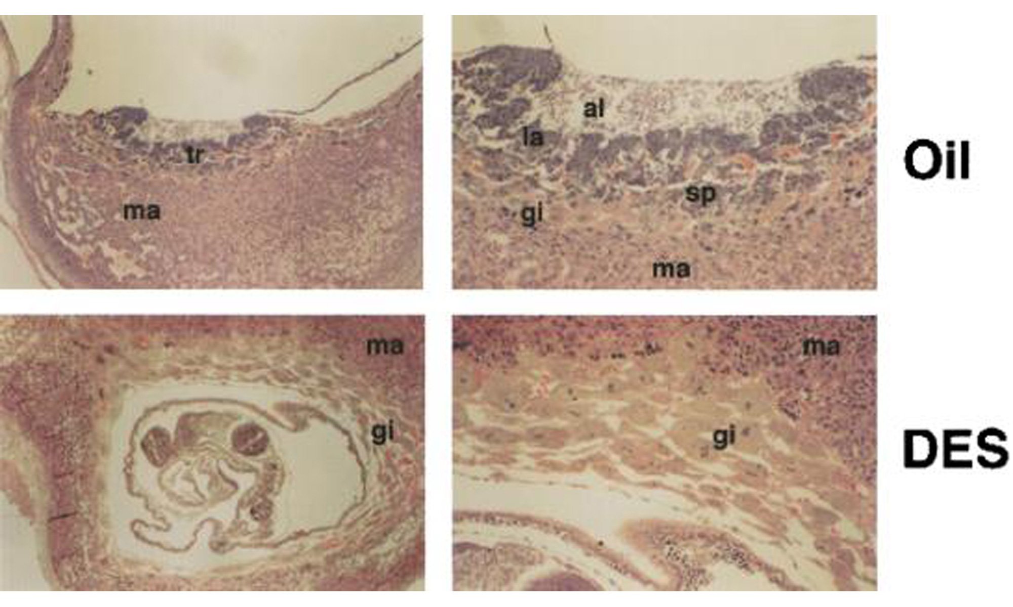 image of DES and ERRβ