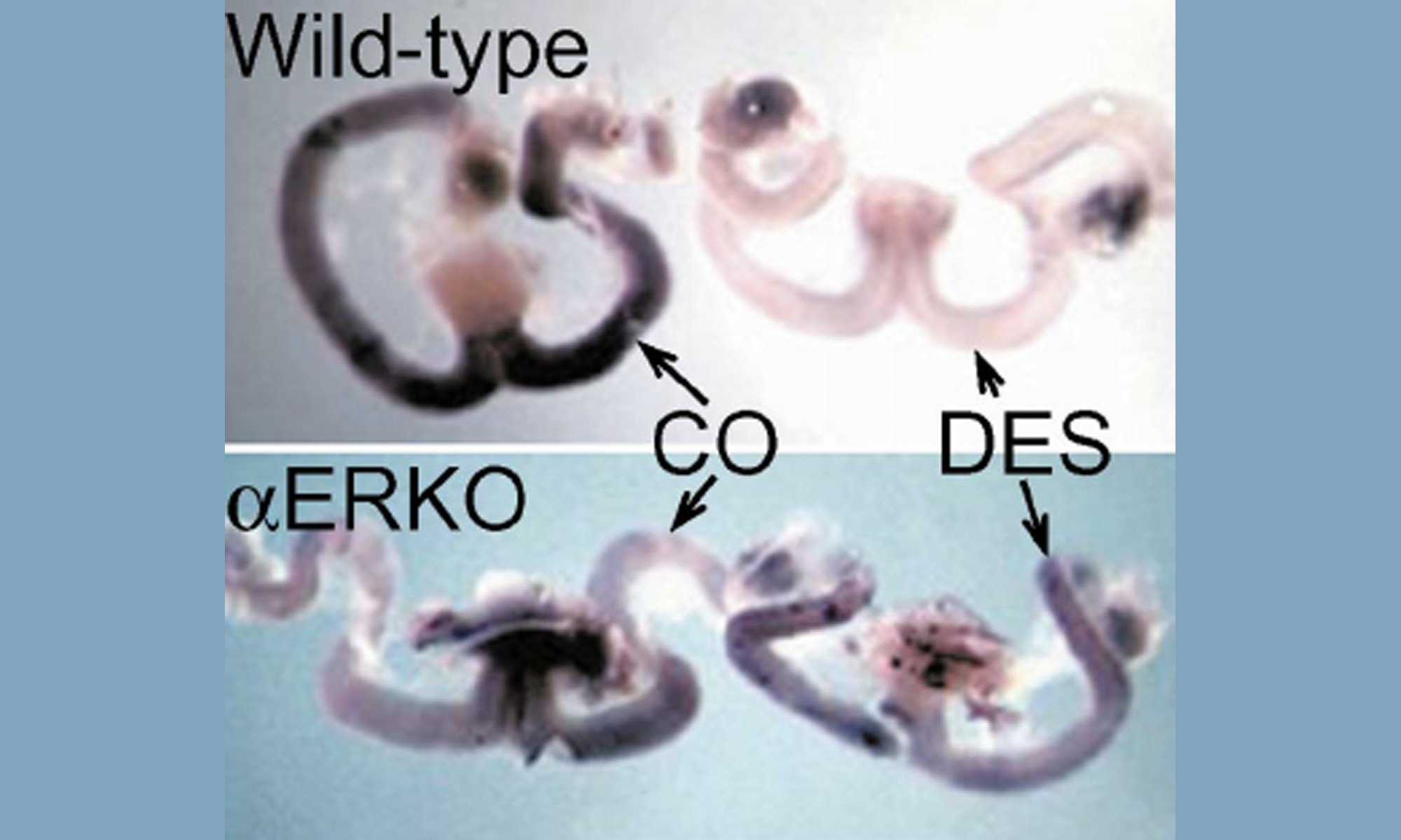 image of Hoxa10 and Hoxa11 expression in the uteri