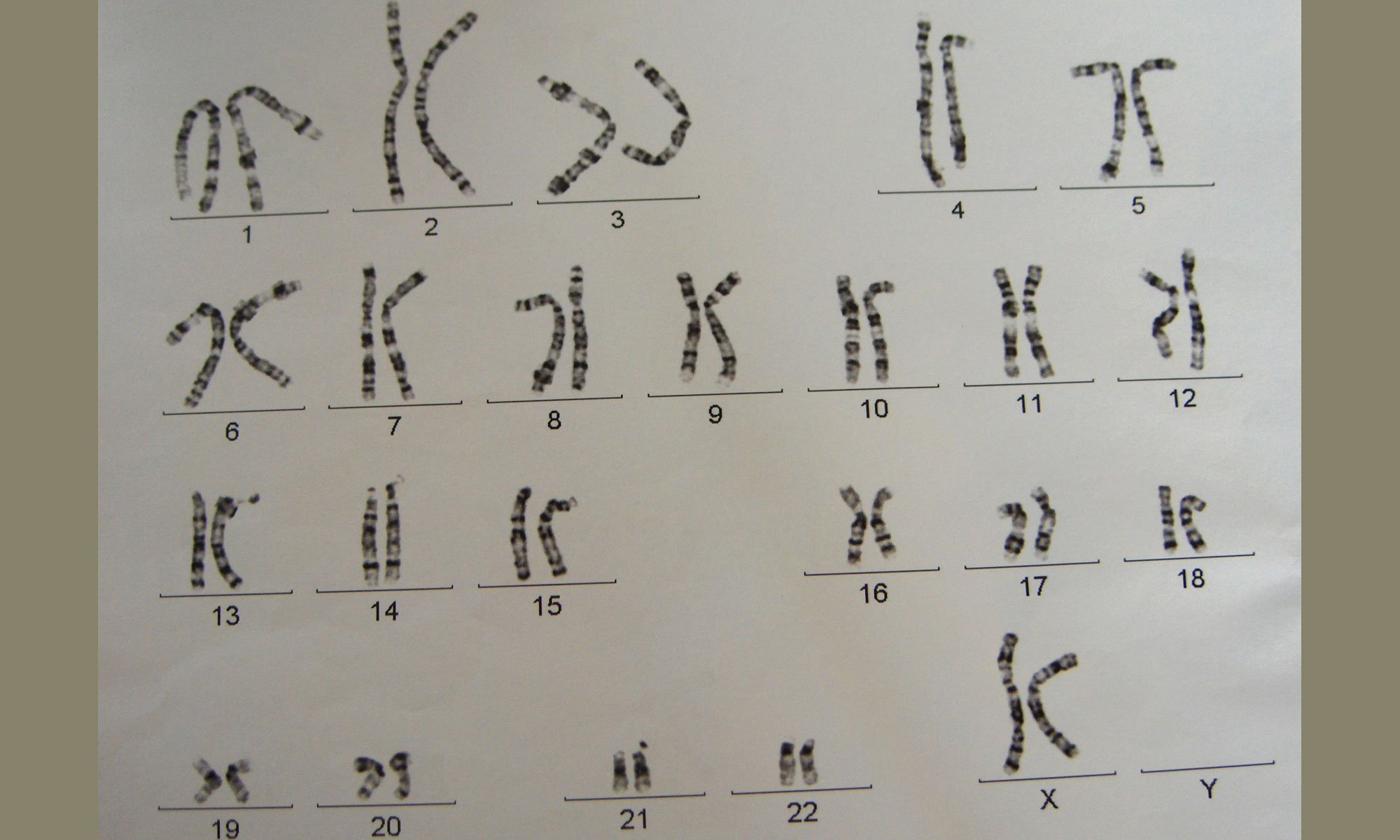 image of chromosomes