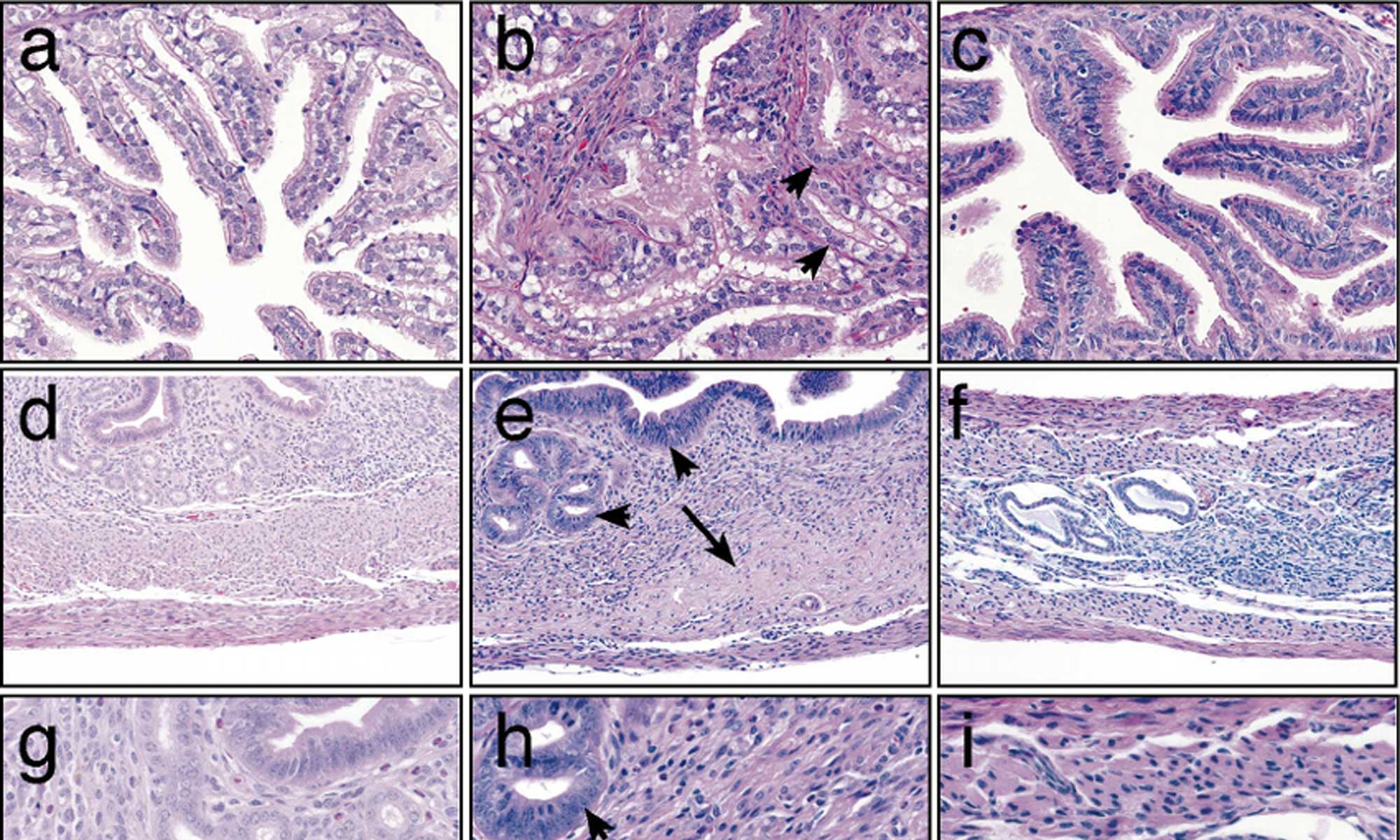 image of des and hox genes