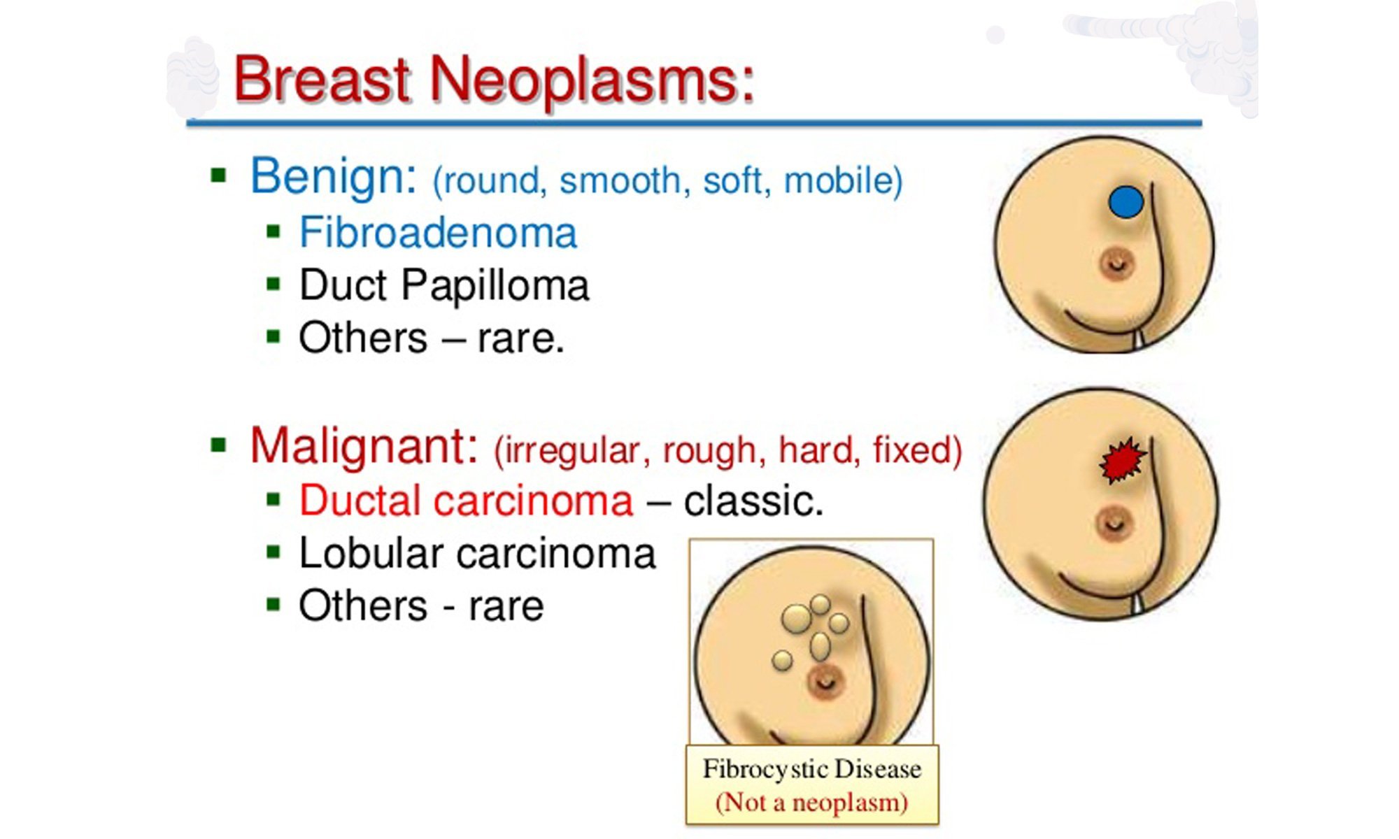 image of breast-neoplasms