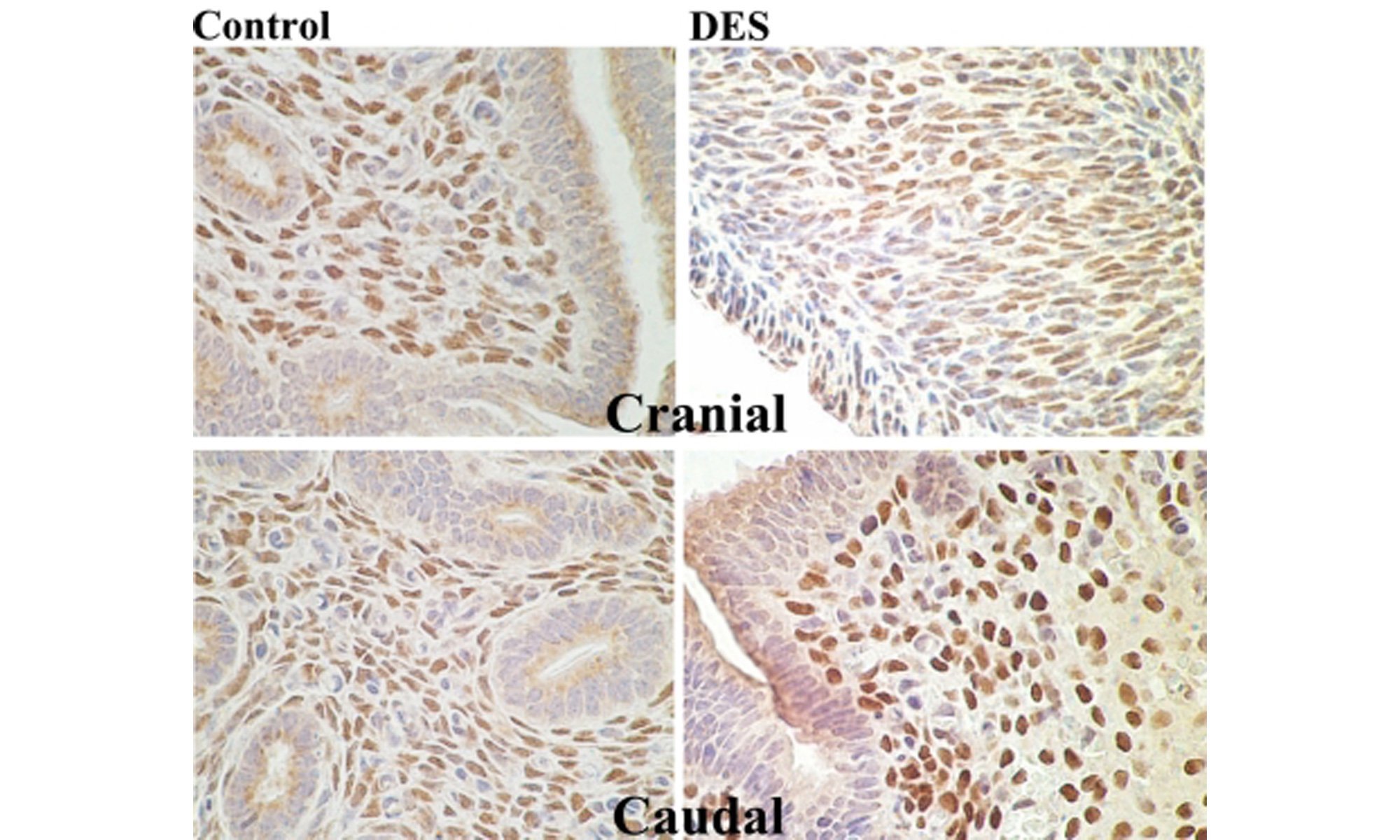 image of homeobox gene HOXA10 expression