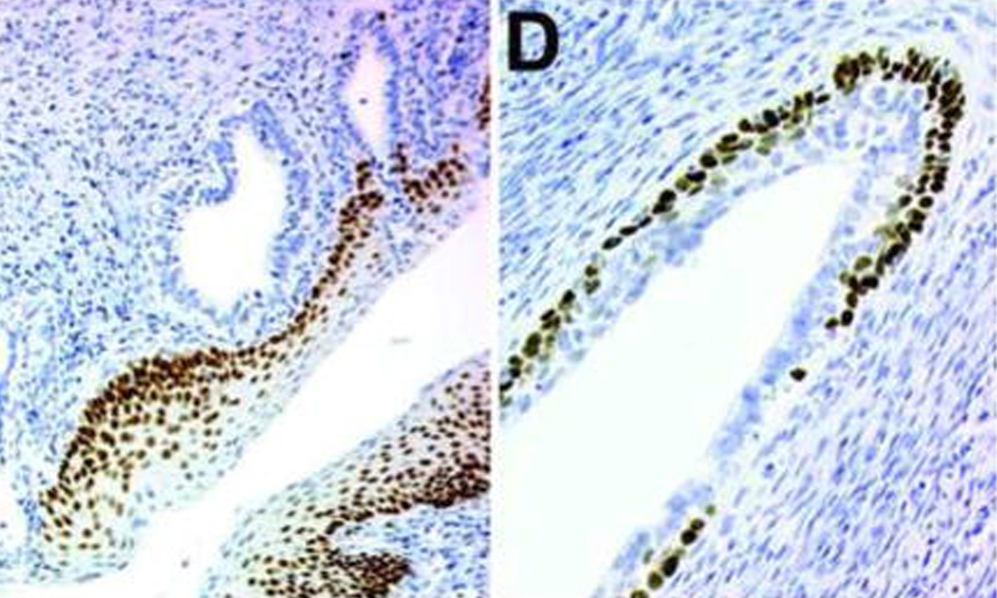 image of TRP63 in the vaginae of C57BL6 adult (P60) mice injected with DES