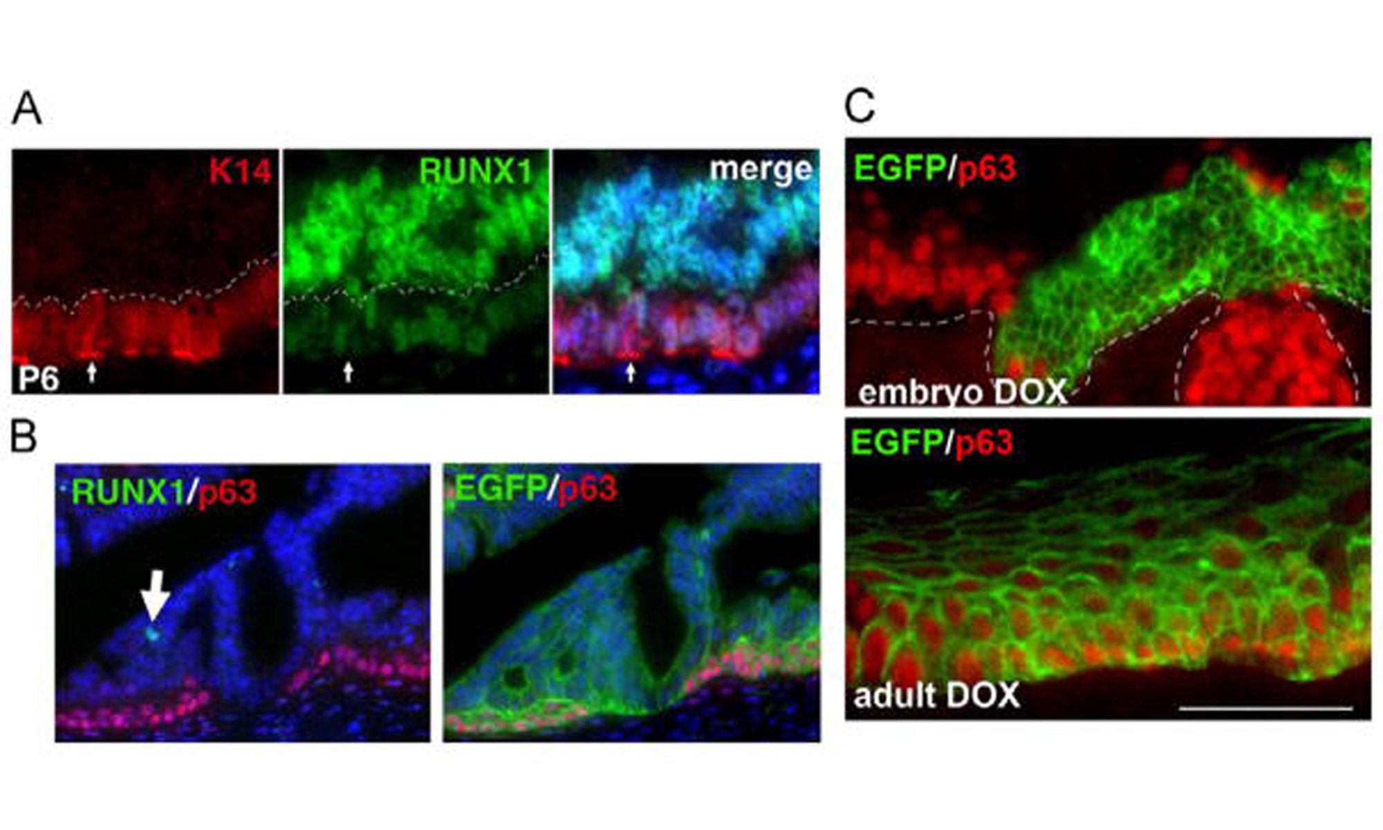 image of downregulation of RUNX1