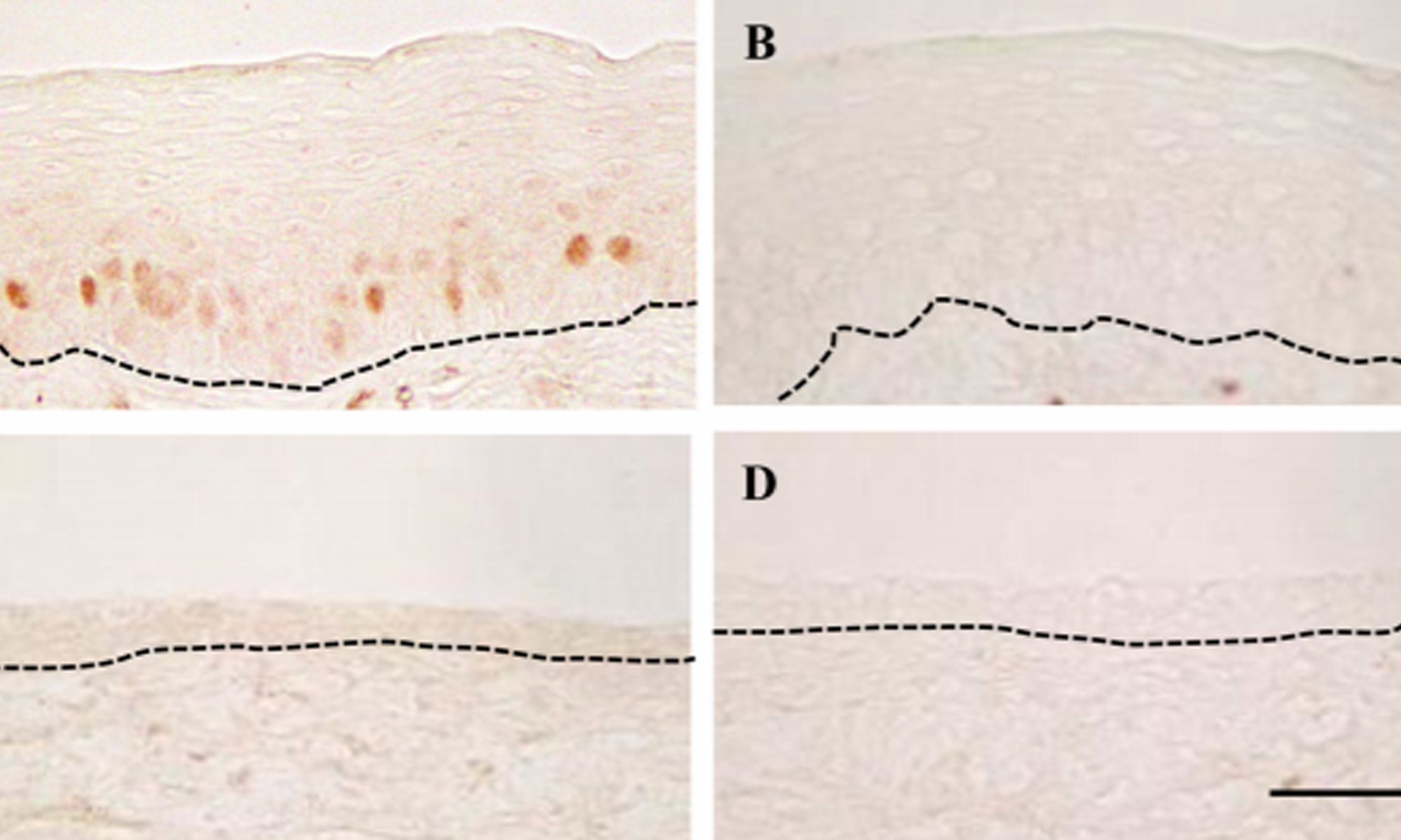image of p21 altered by neonatal diethylstilbestrol exposure