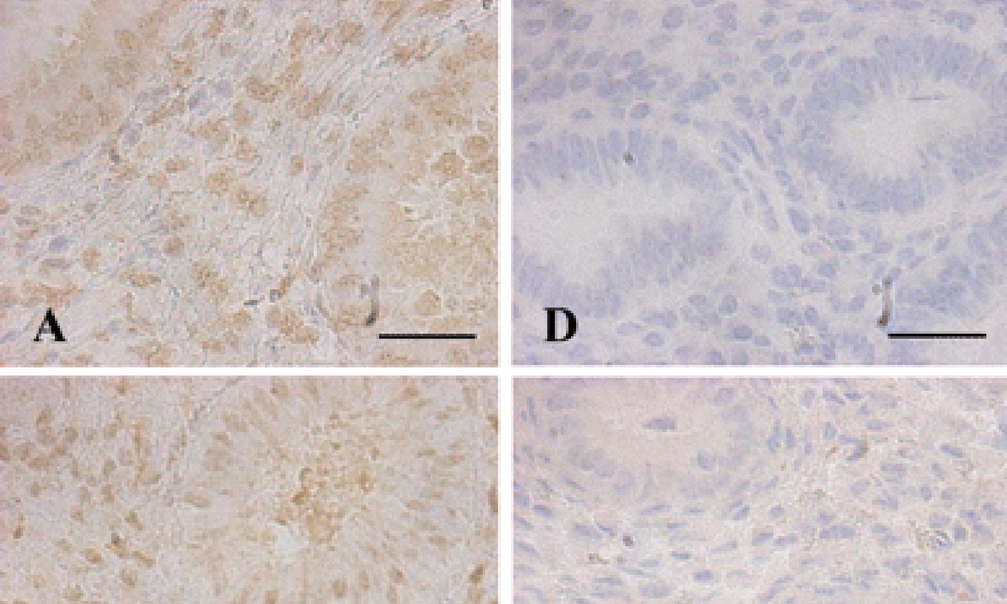 image of DNA methyltransferase expression in the human endometrium