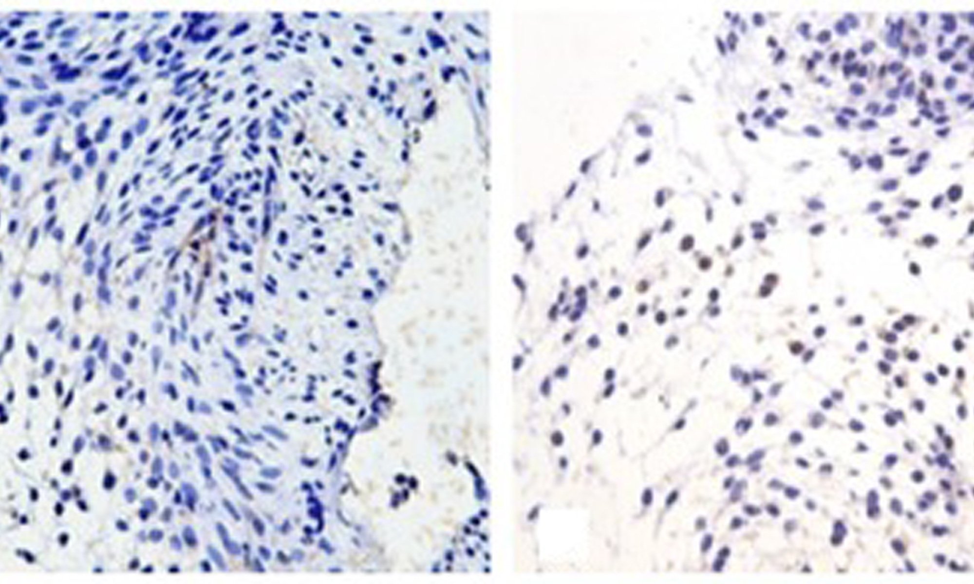 image of Expression of GPER in mouse gubernaculums testis