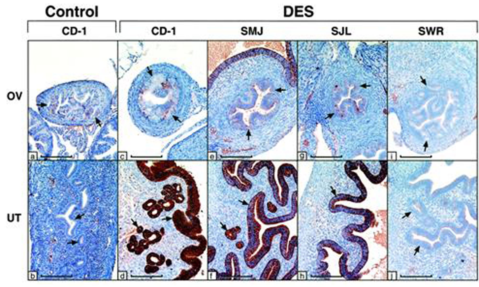 image of lactoferrin-gene and DES response