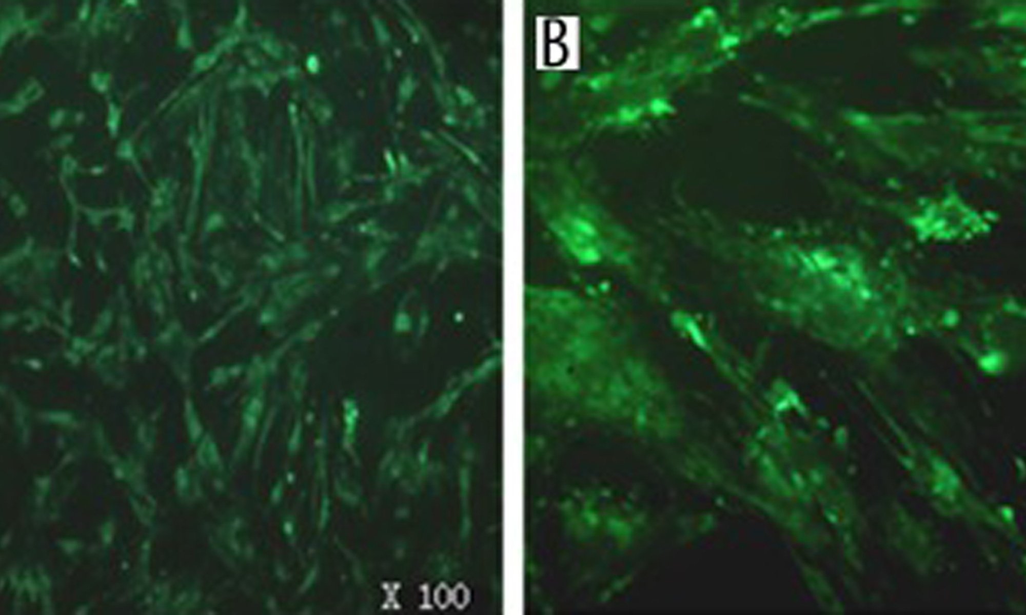 image of LGR8 mRNA