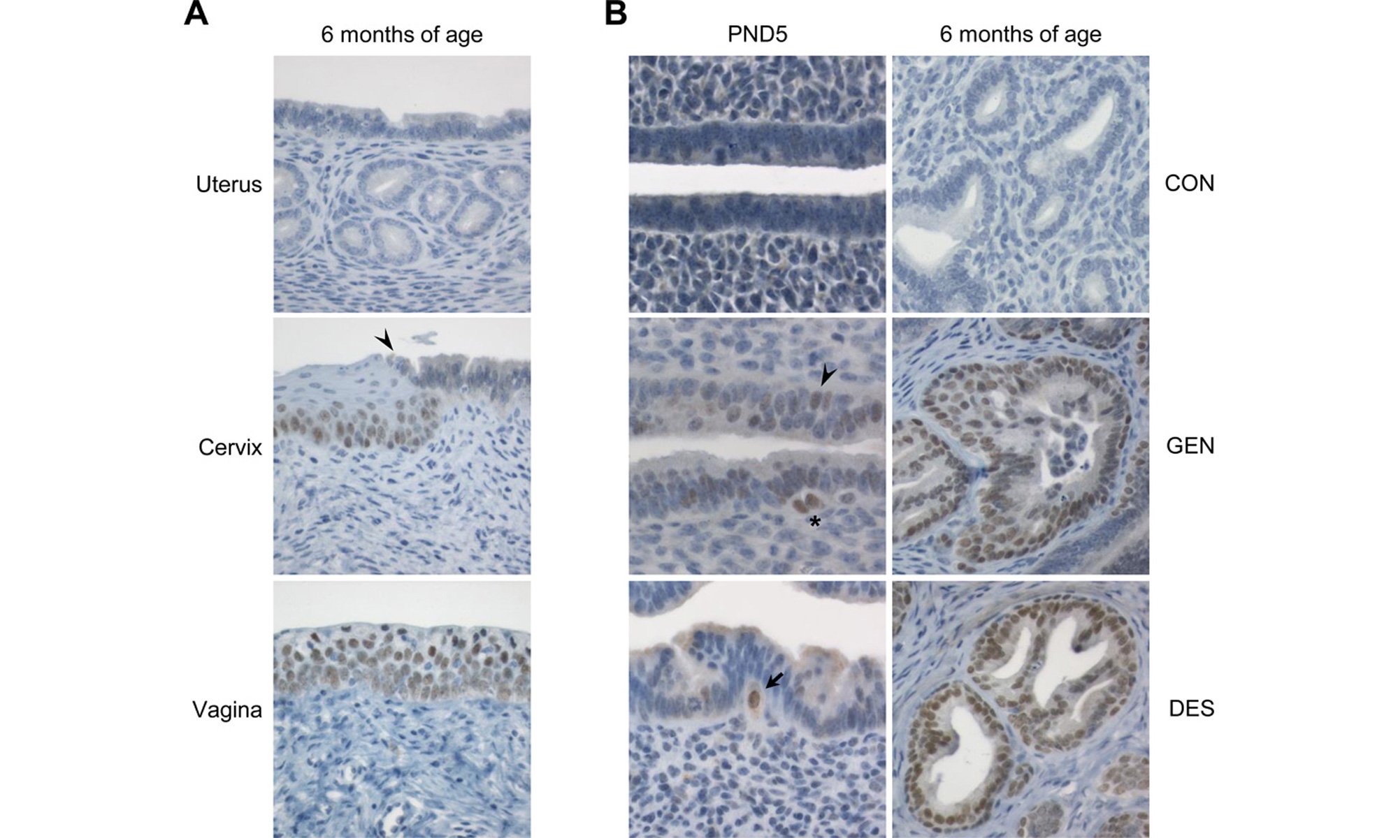 image of protein SIX1 expression