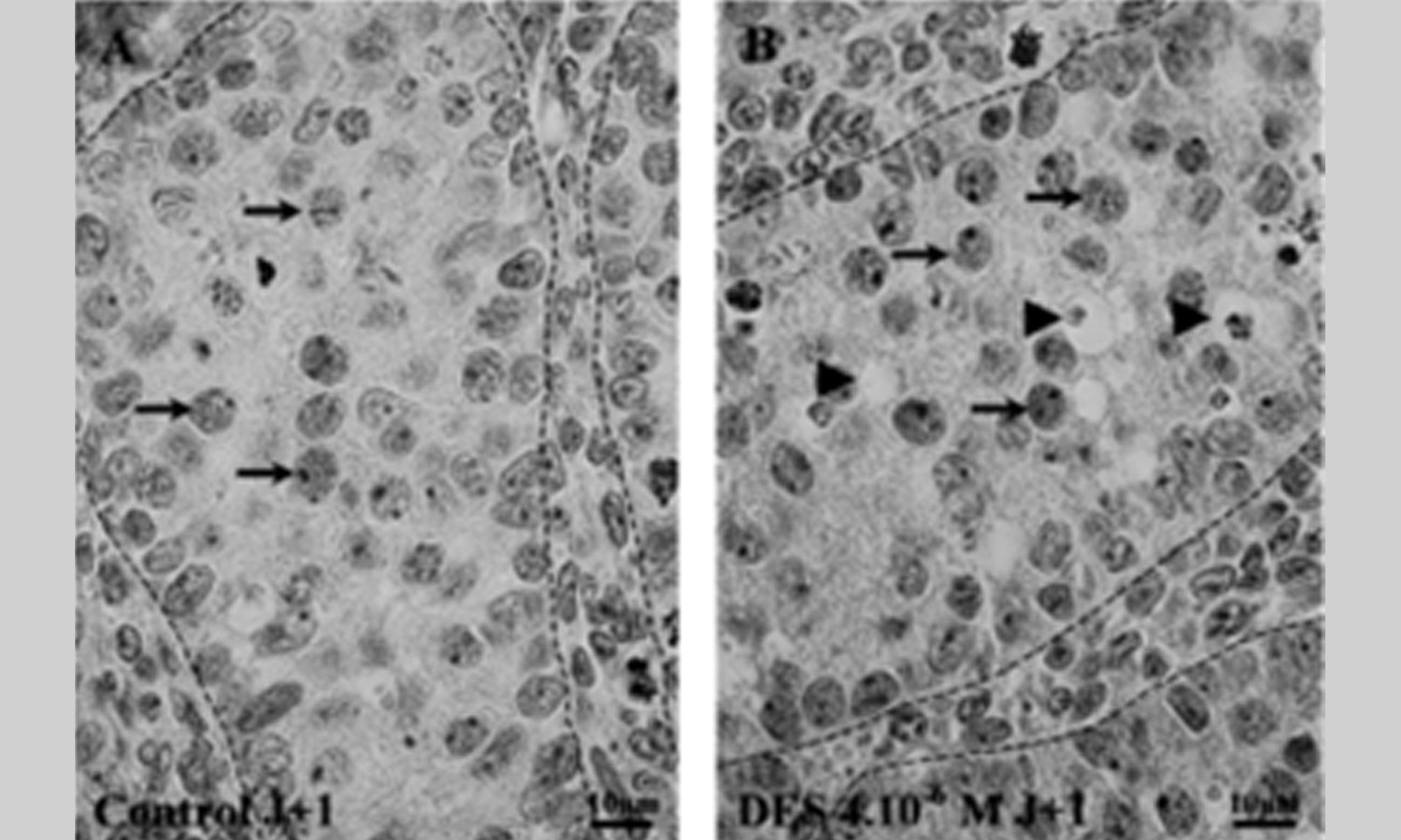 Image of DES and gonocytes