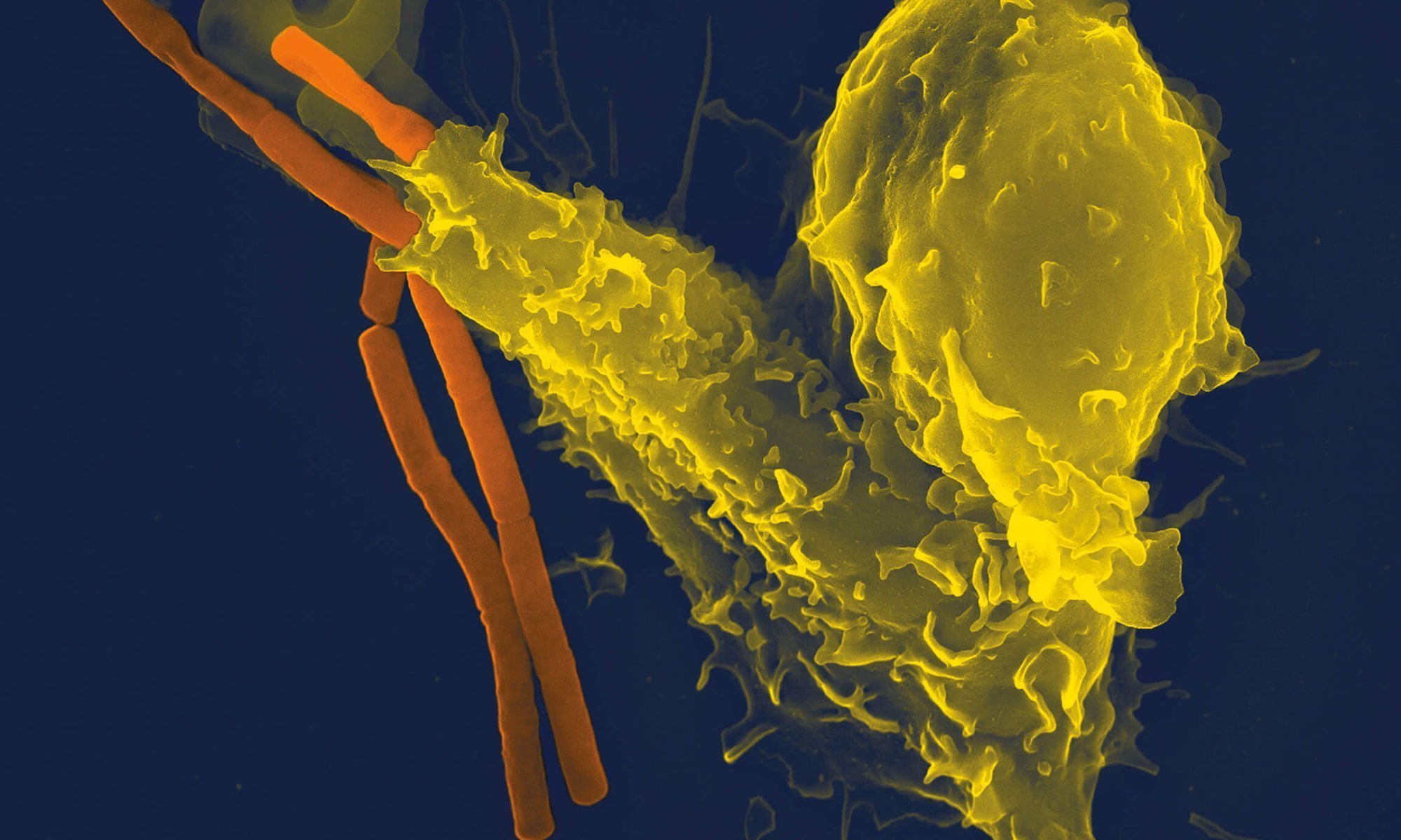 image of Immune alterations