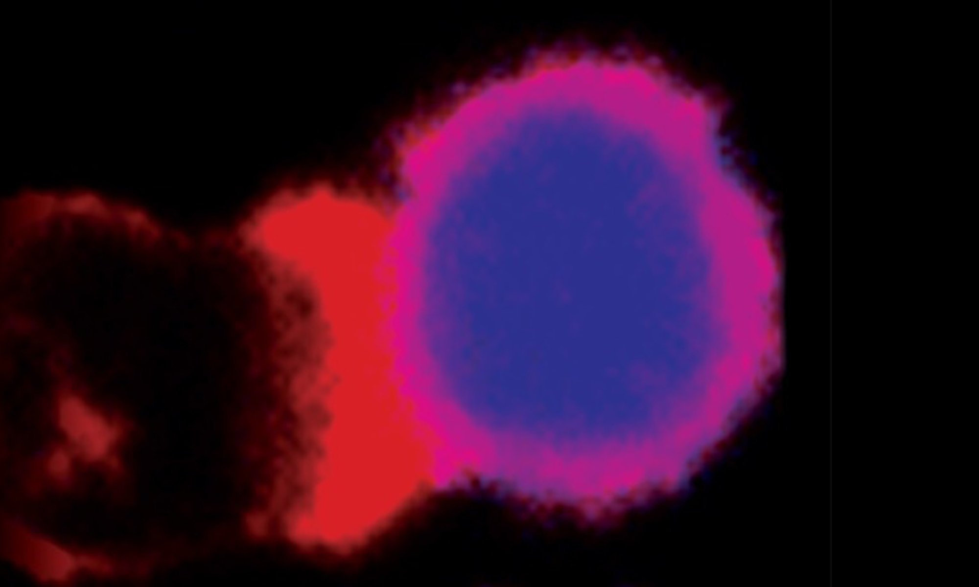 image of Impaired T-cell
