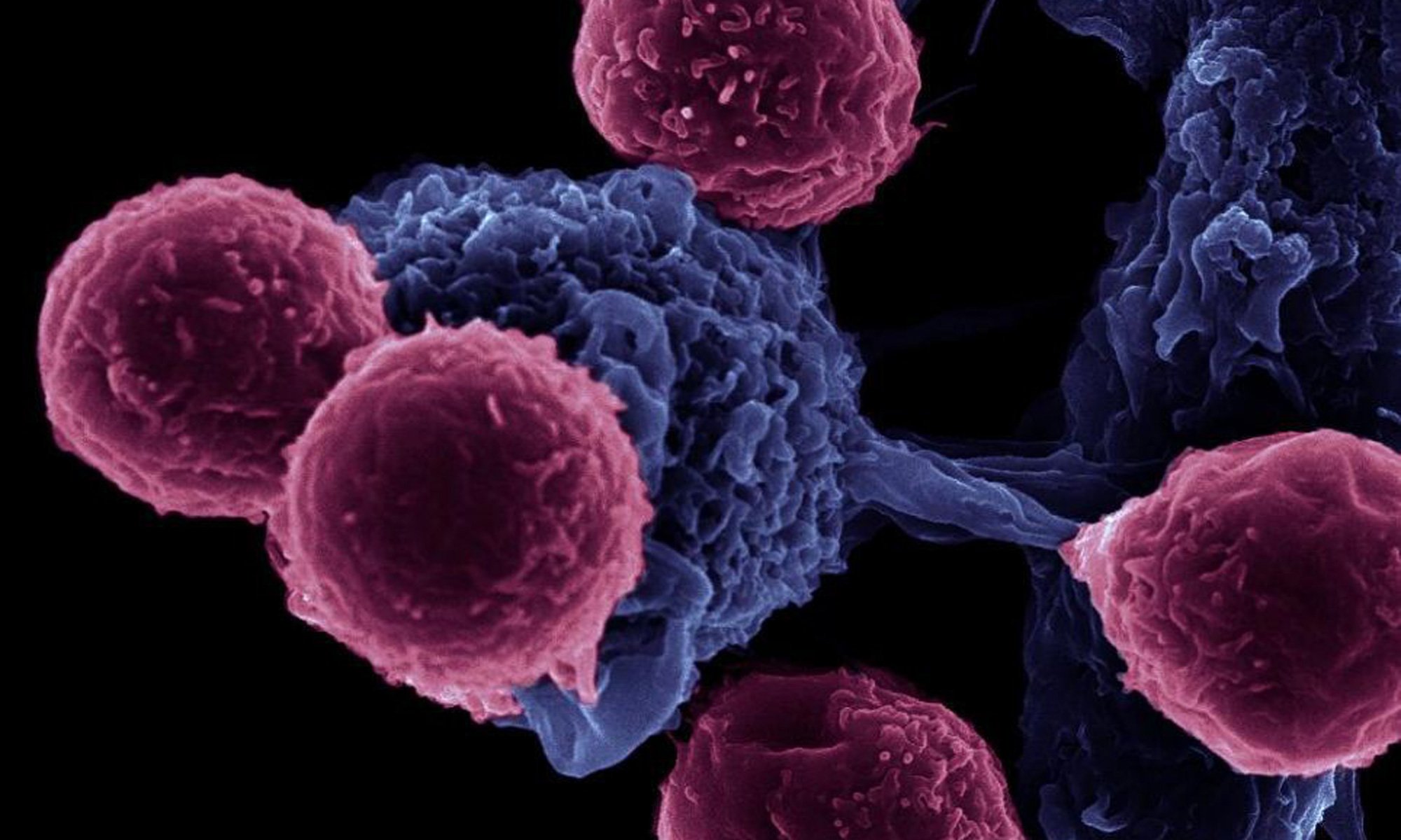 image of Natural killer (NK) cells