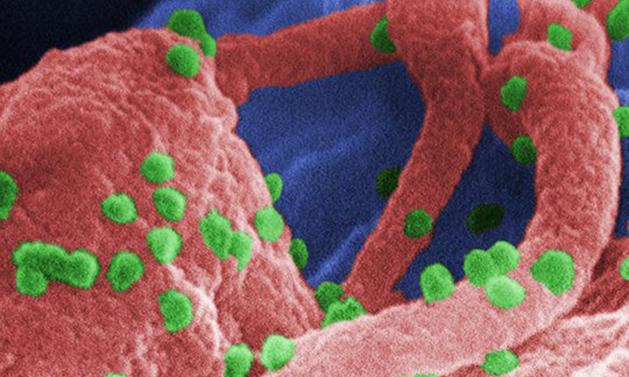 image of immunodeficiency-persistance