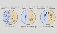 Sperm count and delayed conception