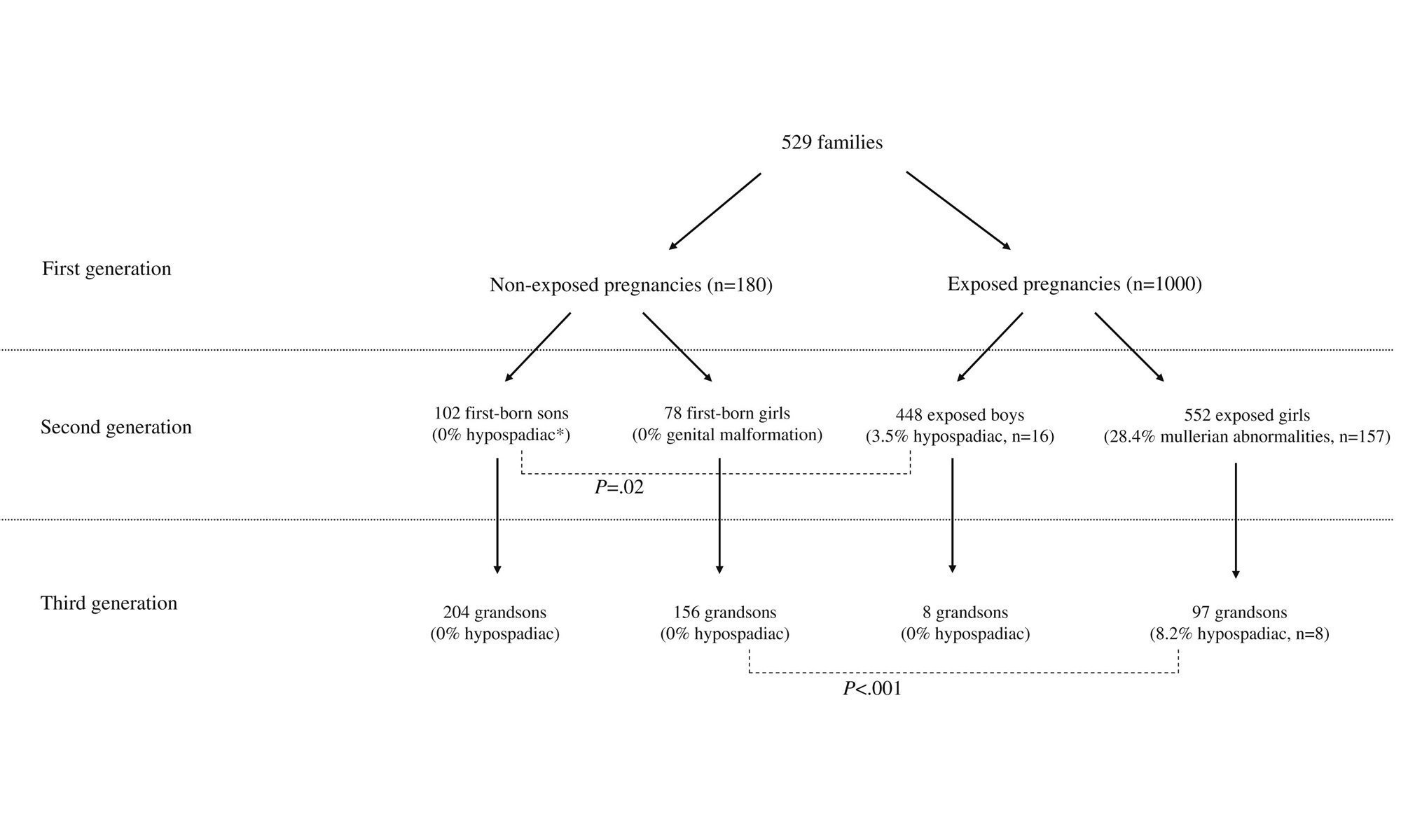 image of third-generation hypospadias