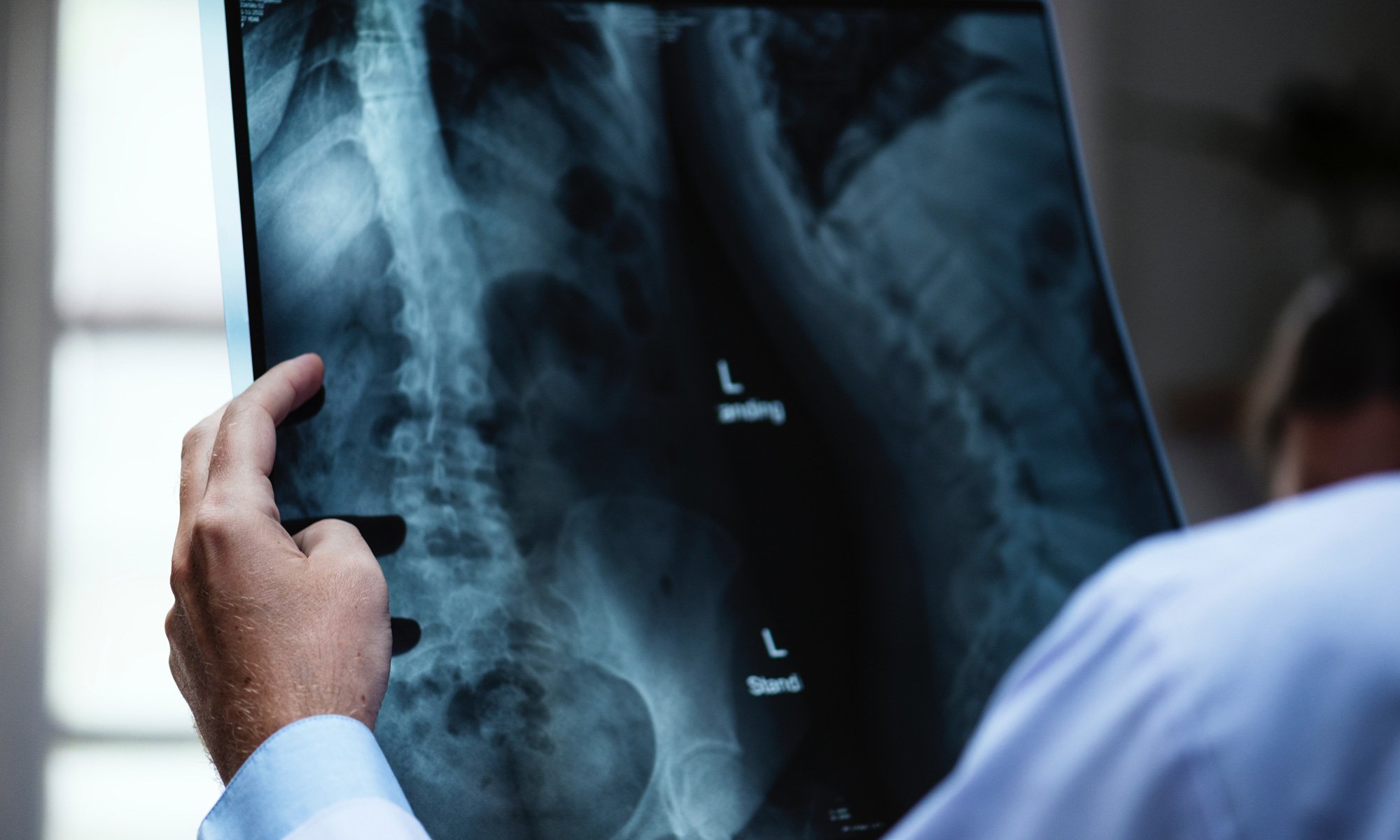 image of des exposed skeleton