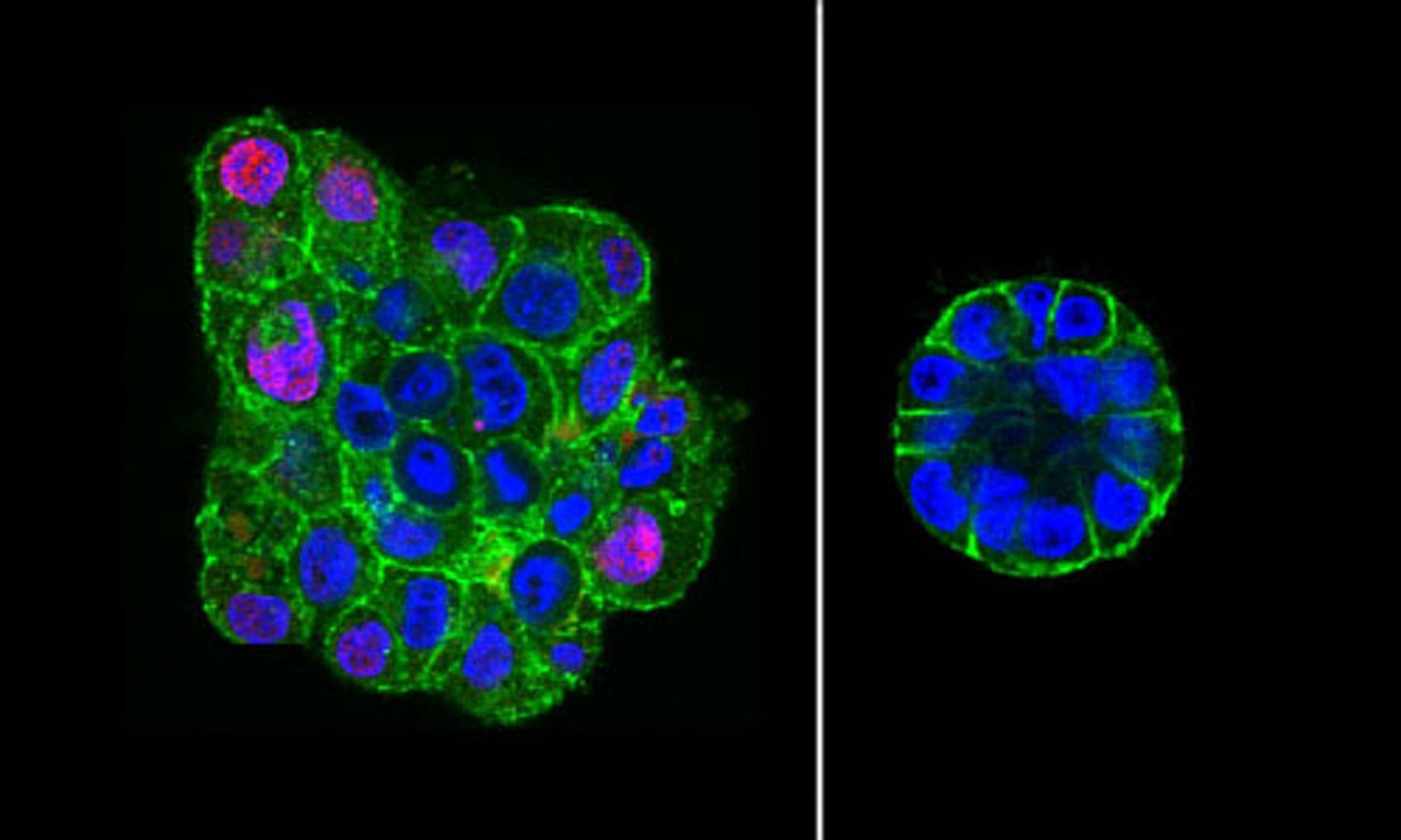 image of breast epithelial cells