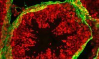 Pre-natal and peri-natal exposures and risk of testicular germ-cell cancer