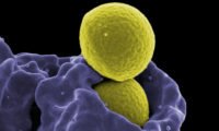 Immunological Effects Following In Utero Exposure to DES