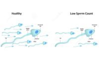 Effects of DES on Male Fertility