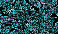 Are estrogens carcinogenic during development of the testes?