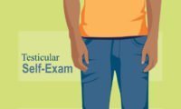 DES and testicular cancer connection : routine self-exam recommended