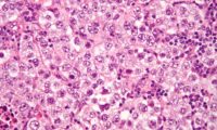 Etiologic factors in testicular germ cell tumors